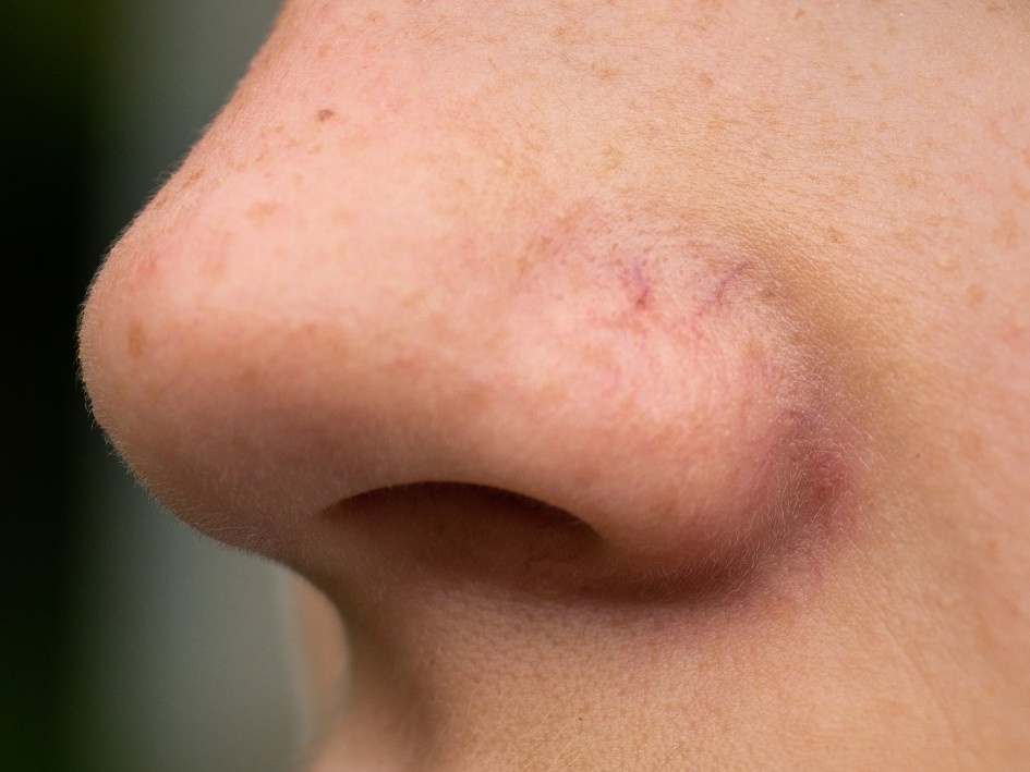 Humming (zumbido nasal)