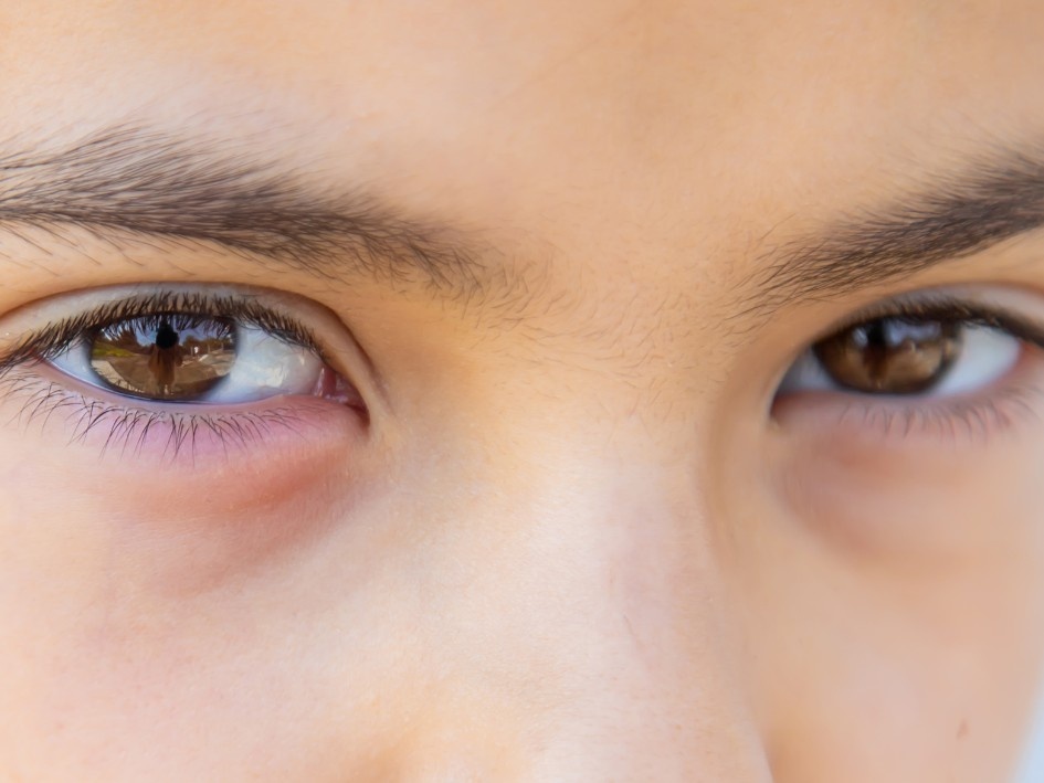 Mirada suave a 180°